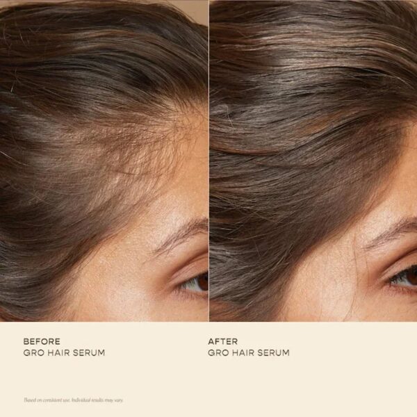 GRO Hair Serum